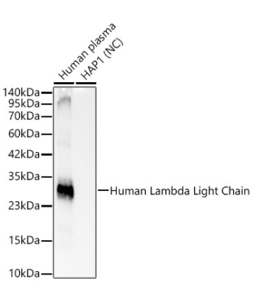 Human Lambda Light Chain Rabbit Monoclonal Antibody