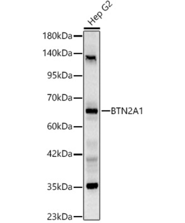 BTN2A1 Rabbit Polyclonal Antibody