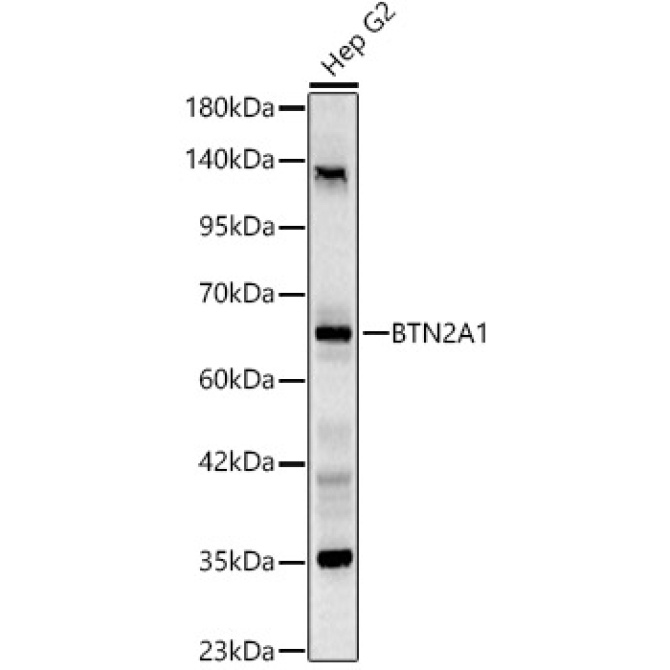 BTN2A1 Rabbit Polyclonal Antibody