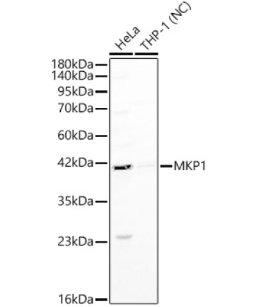 MKP1 Rabbit Polyclonal Antibody