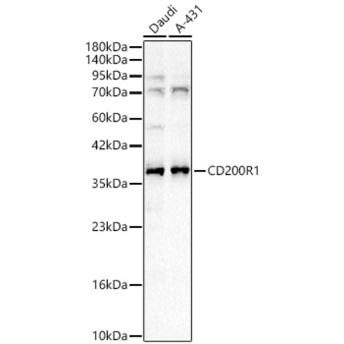 CD200R1 Rabbit Polyclonal Antibody