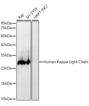 Human Kappa Light Chain Rabbit Monoclonal Antibody
