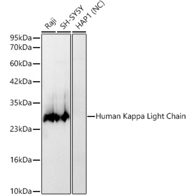 Human Kappa Light Chain Rabbit Monoclonal Antibody