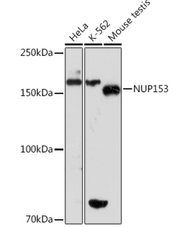 NUP153 Rabbit Monoclonal Antibody