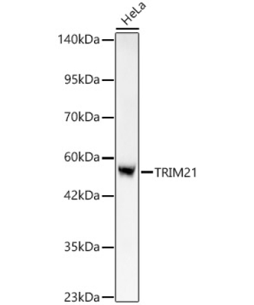 TRIM21/SS-A Rabbit Monoclonal Antibody [KO Validated]