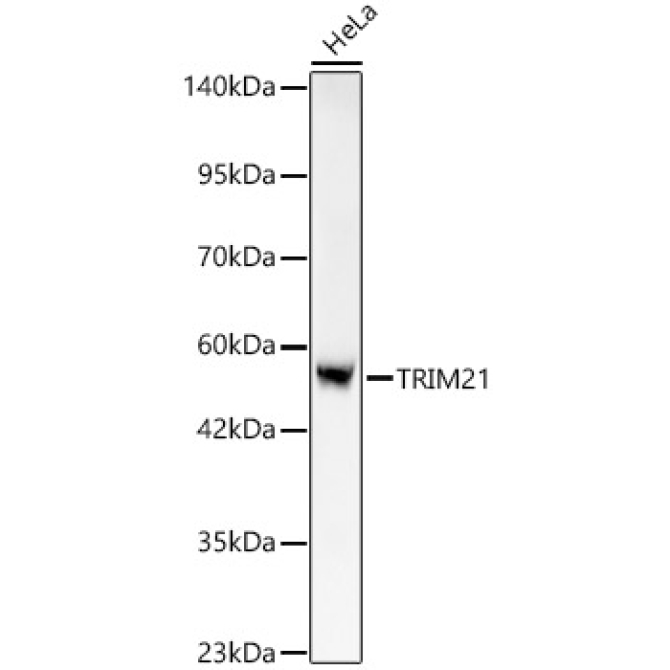 TRIM21/SS-A Rabbit Monoclonal Antibody [KO Validated]