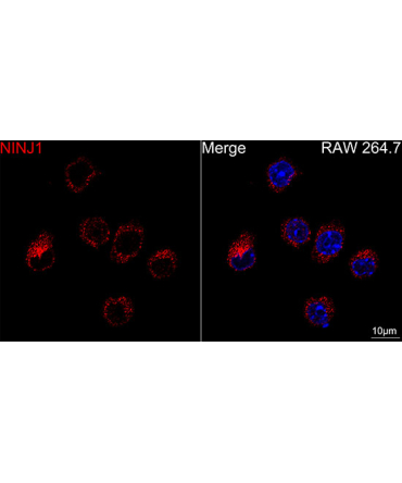 NINJ1 Rabbit Monoclonal Antibody