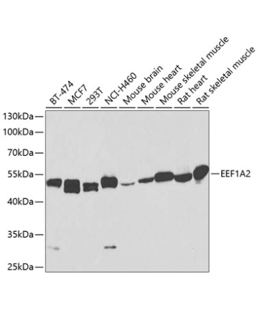 EEF1A2 Rabbit Polyclonal Antibody