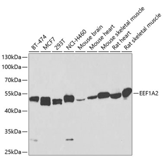 EEF1A2 Rabbit Polyclonal Antibody