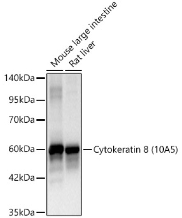 Cytokeratin 8 Mouse Monoclonal Antibody
