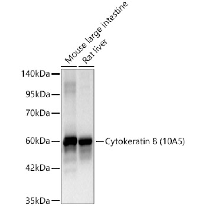 Cytokeratin 8 Mouse Monoclonal Antibody