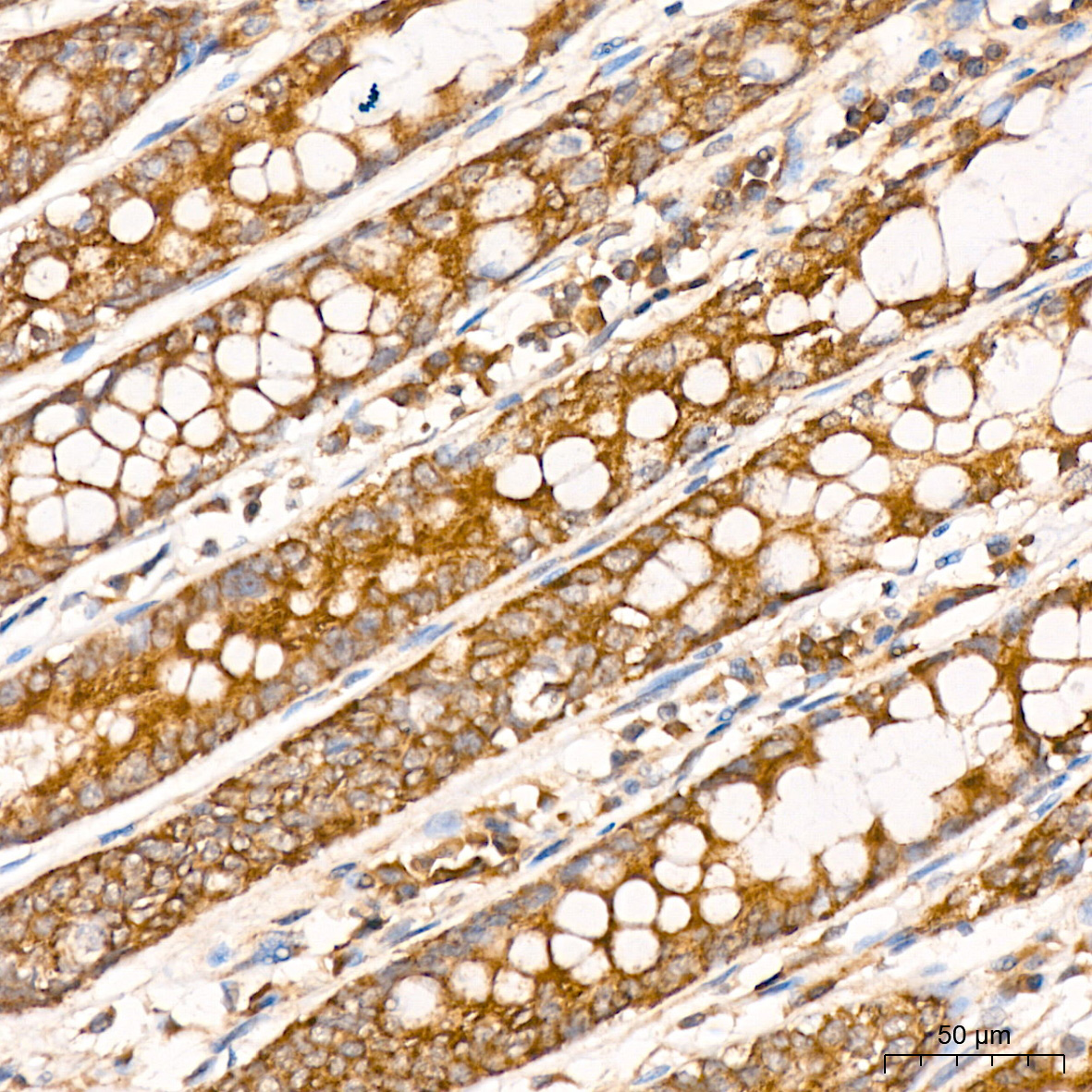ACSM1 Rabbit Polyclonal Antibody