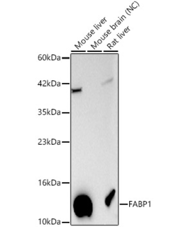 FABP1 Rabbit Polyclonal Antibody