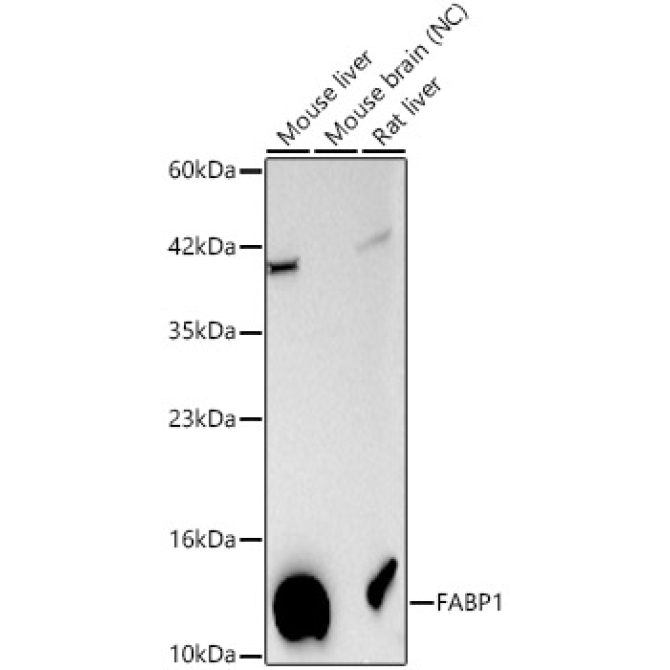 FABP1 Rabbit Polyclonal Antibody