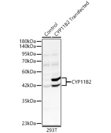 CYP11B2 Rabbit Polyclonal Antibody