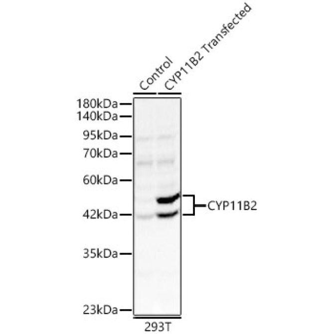 CYP11B2 Rabbit Polyclonal Antibody