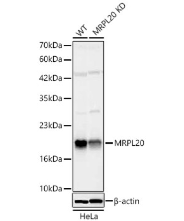 MRPL20 Rabbit Polyclonal Antibody [KD Validated]