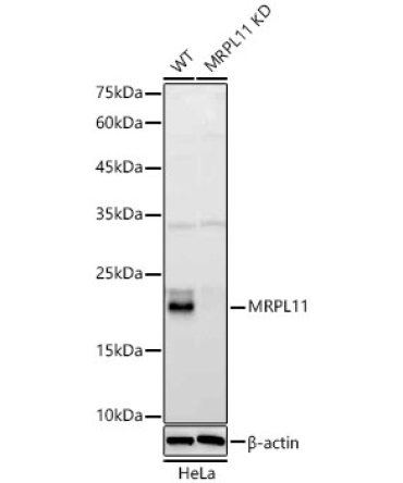 MRPL11 Rabbit Polyclonal Antibody [KD Validated]