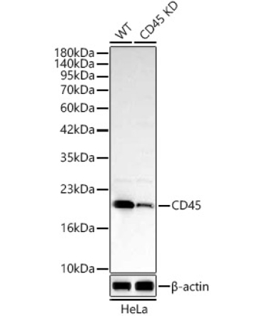 MRPL13 Rabbit Polyclonal Antibody [KD Validated]