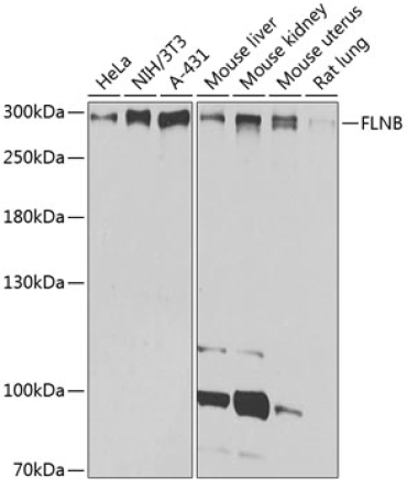 FLNB Rabbit Polyclonal Antibody