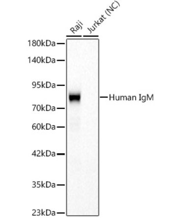 Human IgM Rabbit Monoclonal Antibody