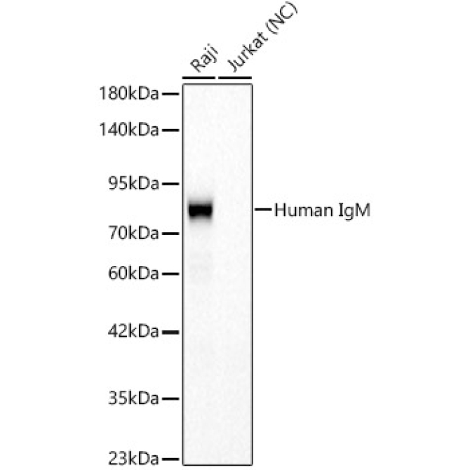 Human IgM Rabbit Monoclonal Antibody