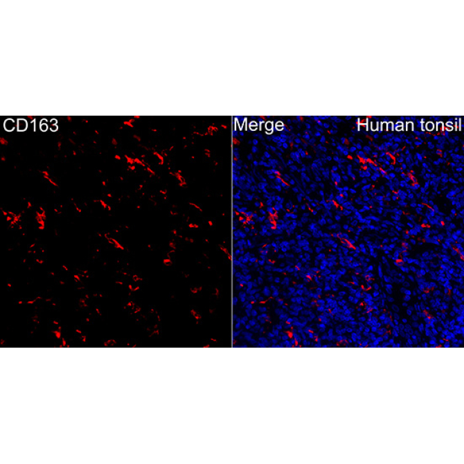 CD163 Rabbit Polyclonal Antibody