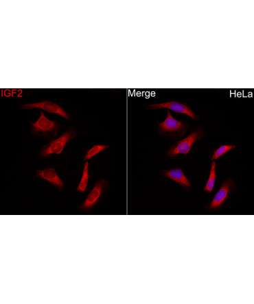 IGF2 Rabbit Polyclonal Antibody