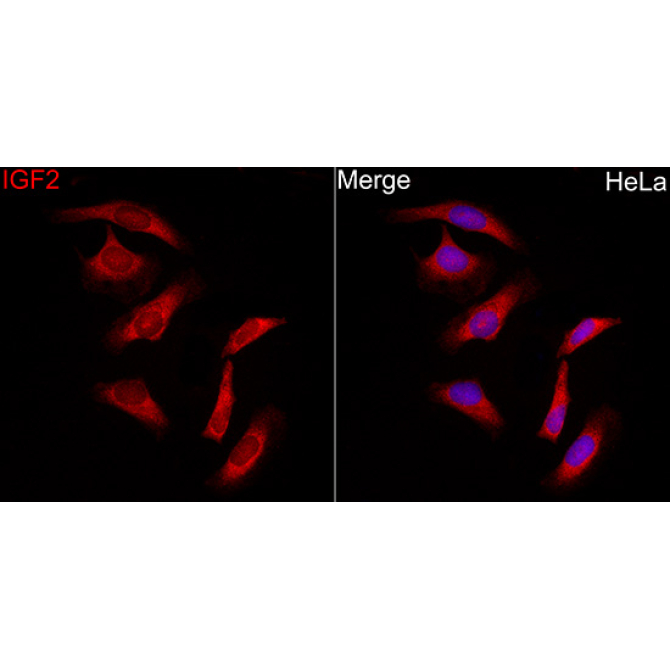 IGF2 Rabbit Polyclonal Antibody