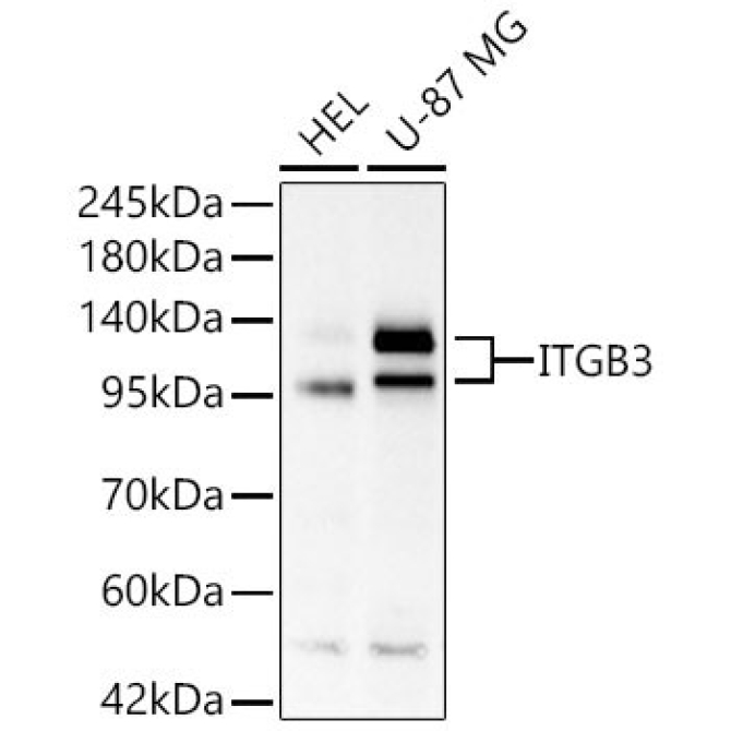ITGB3 Rabbit Polyclonal Antibody