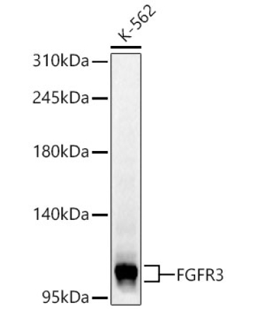 FGFR3 Rabbit Polyclonal Antibody [KD Validated]