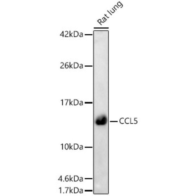 CCL5 Rabbit Polyclonal Antibody