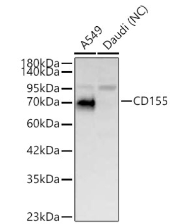 CD155 Rabbit Polyclonal Antibody