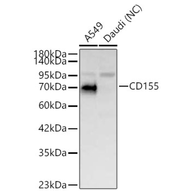 CD155 Rabbit Polyclonal Antibody