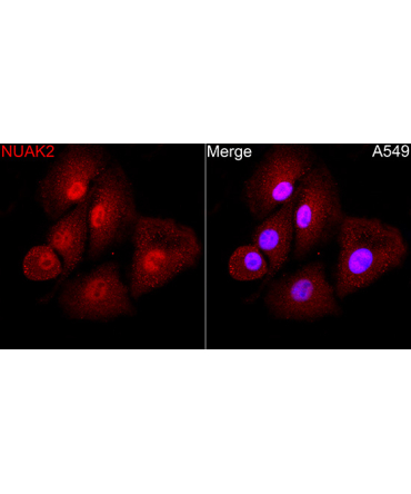 NUAK2 Rabbit Polyclonal Antibody