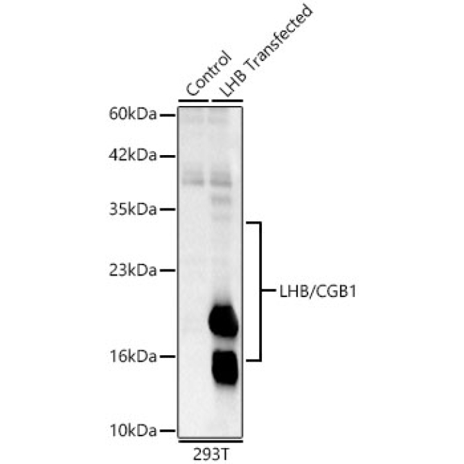 LHB/CGB1 Rabbit Polyclonal Antibody