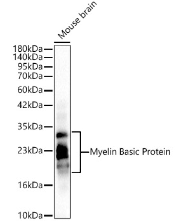 Myelin Basic Protein/MBP Rabbit Polyclonal Antibody