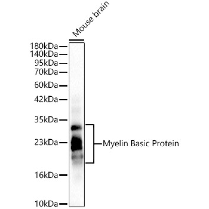 Myelin Basic Protein/MBP Rabbit Polyclonal Antibody