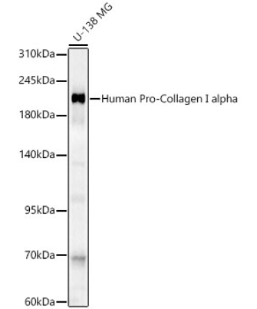 Human Pro-Collagen I alpha Rabbit Polyclonal Antibody
