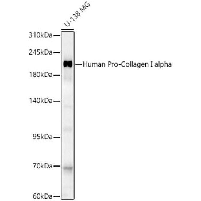 Human Pro-Collagen I alpha Rabbit Polyclonal Antibody