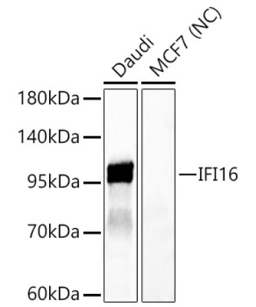 IFI16 Rabbit Polyclonal Antibody