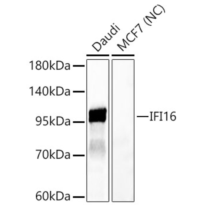 IFI16 Rabbit Polyclonal Antibody
