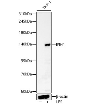 IFIH1 Rabbit Polyclonal Antibody