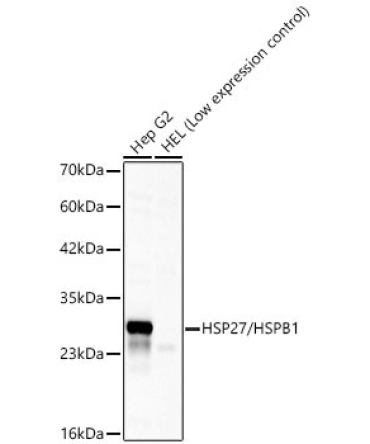 HSP27/HSPB1 Rabbit Polyclonal Antibody