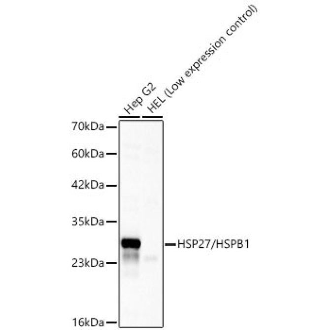 HSP27/HSPB1 Rabbit Polyclonal Antibody