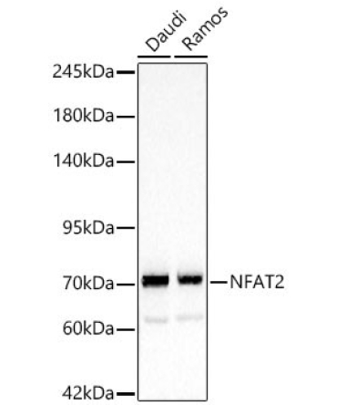 NFAT2 Rabbit Polyclonal Antibody