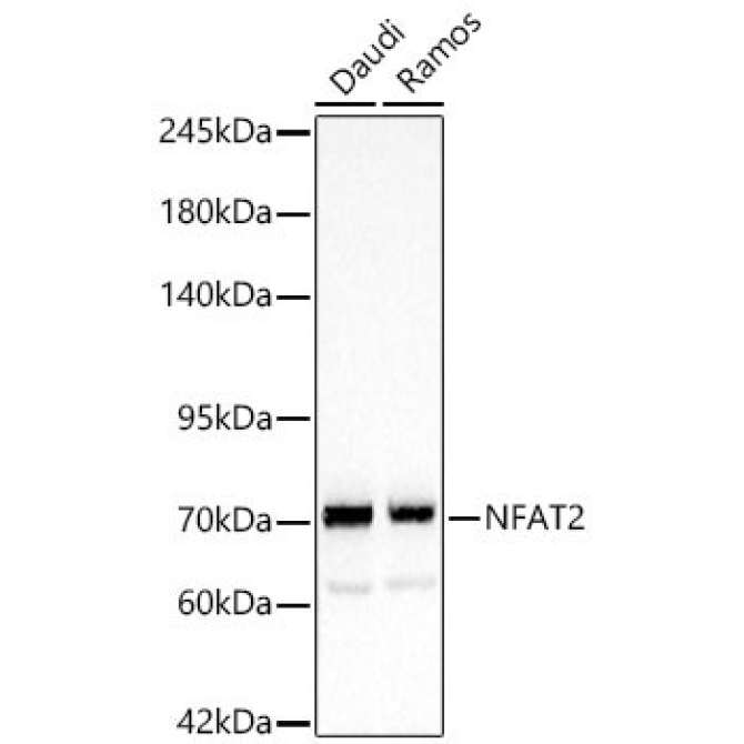 NFAT2 Rabbit Polyclonal Antibody