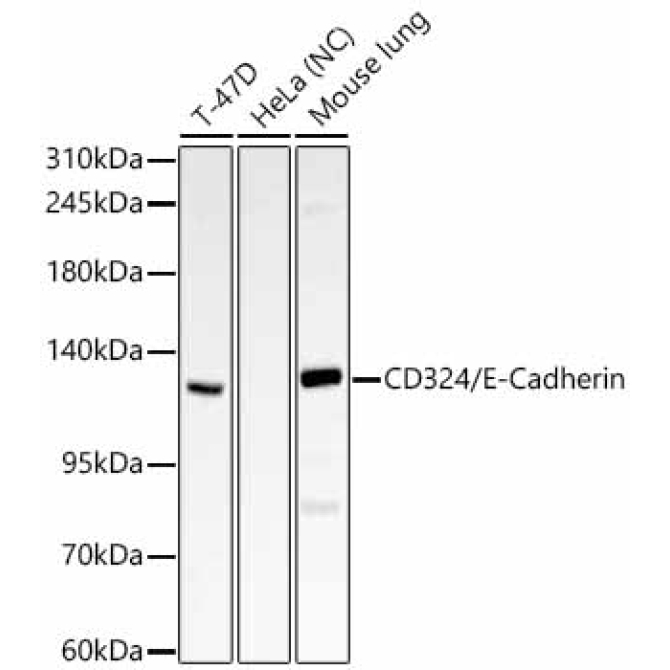 CD324/E-Cadherin Rabbit Polyclonal Antibody