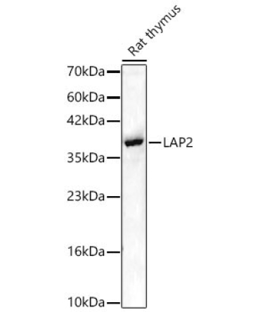 LAP2 Rabbit Polyclonal Antibody