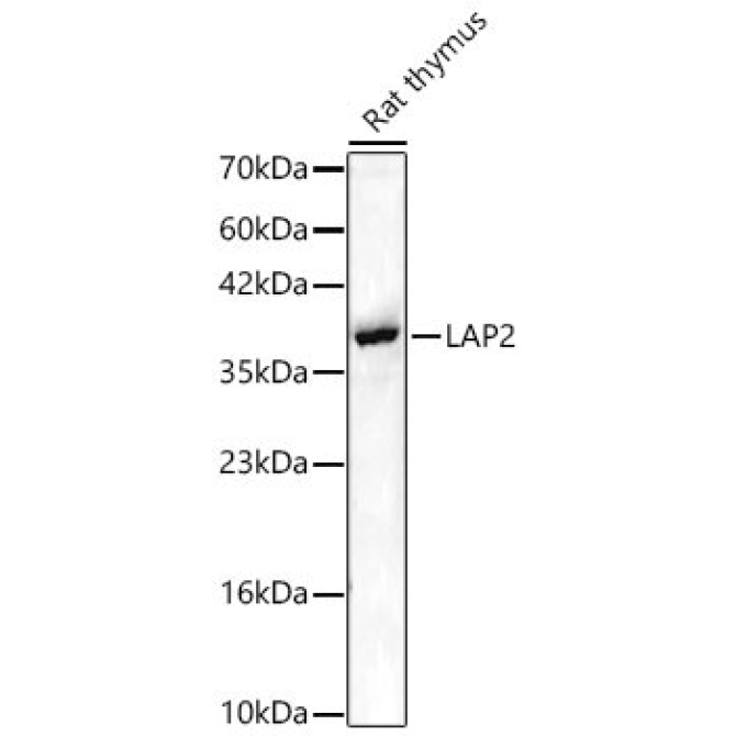 LAP2 Rabbit Polyclonal Antibody